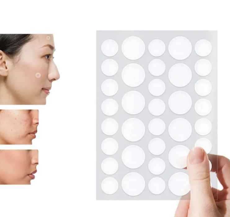 Hydrocolloid acne patches applied to skin to treat blemishes overnight