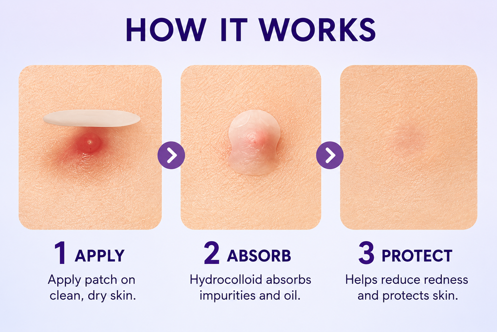 LivaClean Large Hydrocolloid Acne Patches — 60 Count Blemish Treatment